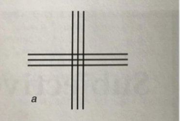 If shown this image, what lines would appear sharper for a WTR patient?