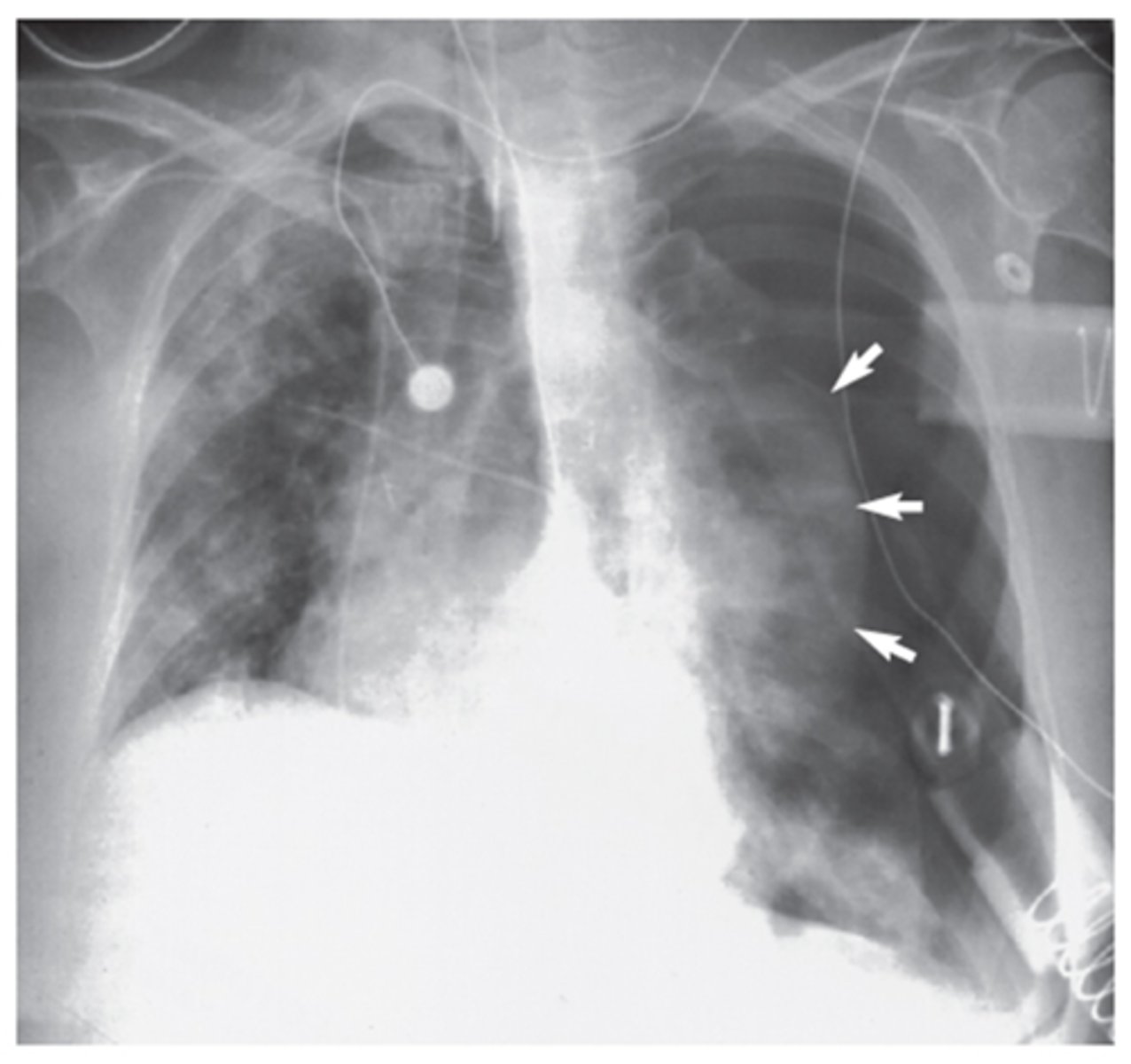 <p>Interpretation?</p>