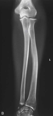 <p>What projection, position, and anatomy is this?</p>