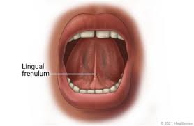 <p>fold of mucus membrane that secures the tongue to floor of the mouth and limits its posterior movement</p>