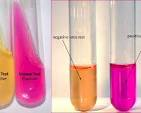 <ul><li><p>urease to break down urea into ammonia and CO2</p></li><li><p>urease breaks down urea into NH3 and CO2, increasing the pH</p></li><li><p>phenol red</p></li><li><p>pos: hot pink</p></li><li><p>neg: yellow (no color change)</p></li></ul><p></p>