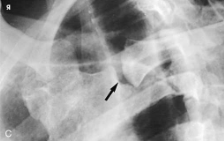 <p>What projection, position and anatomy is this? </p>