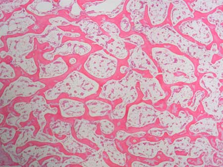 <p>Resist stresses and transfer force, reduce bone weight, support and protects bone marrow. Less matrix.</p>