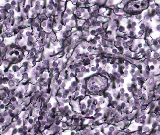 <p>• Fibroblasts</p><p>• Reticular fibers (type III collagen)</p>