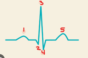 <p>Identify this image. </p>