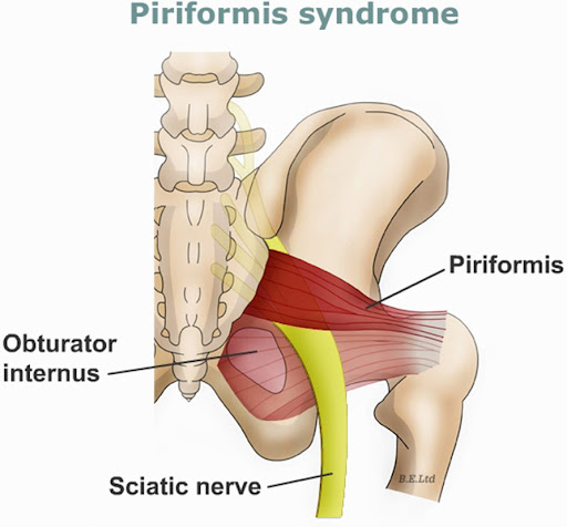 <p>Pear-shaped deep lateral rotator; origin from the anterior sacrum; exits through the greater sciatic foramen to insert near the greater trochanter.</p>