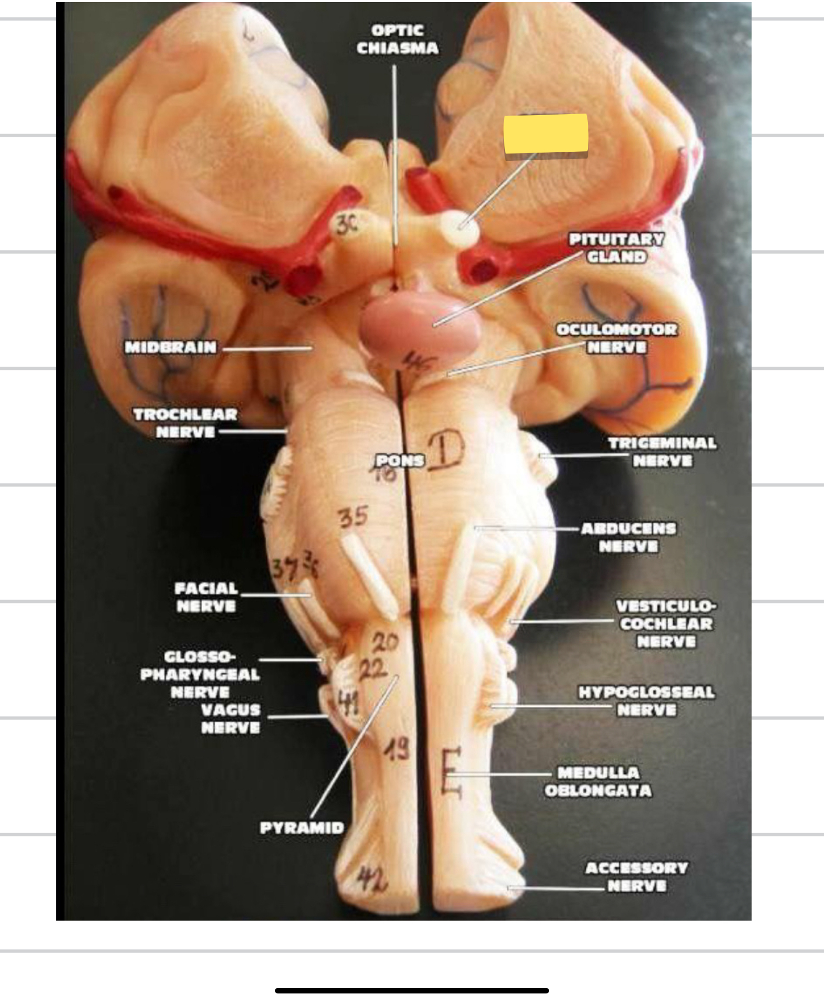 <p>Name this cranial nerve&nbsp;</p>