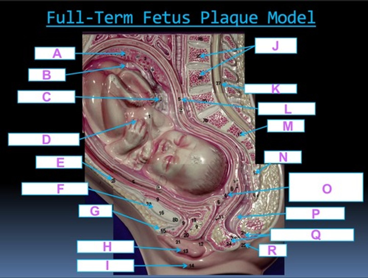 <p>L</p>