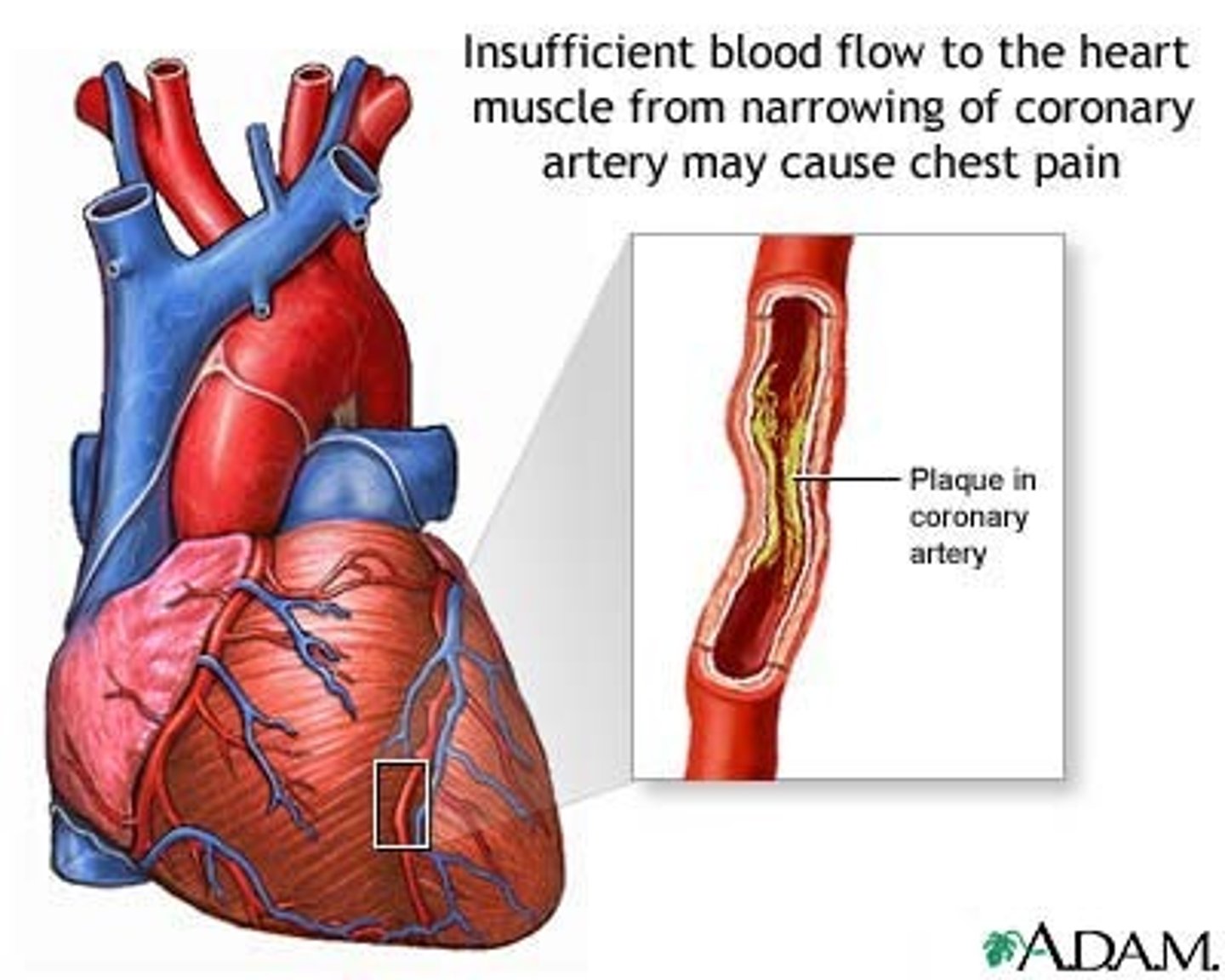 <p>Why is the difference between blood flow in the epicardial and subendocardial arteries clinically important?</p>
