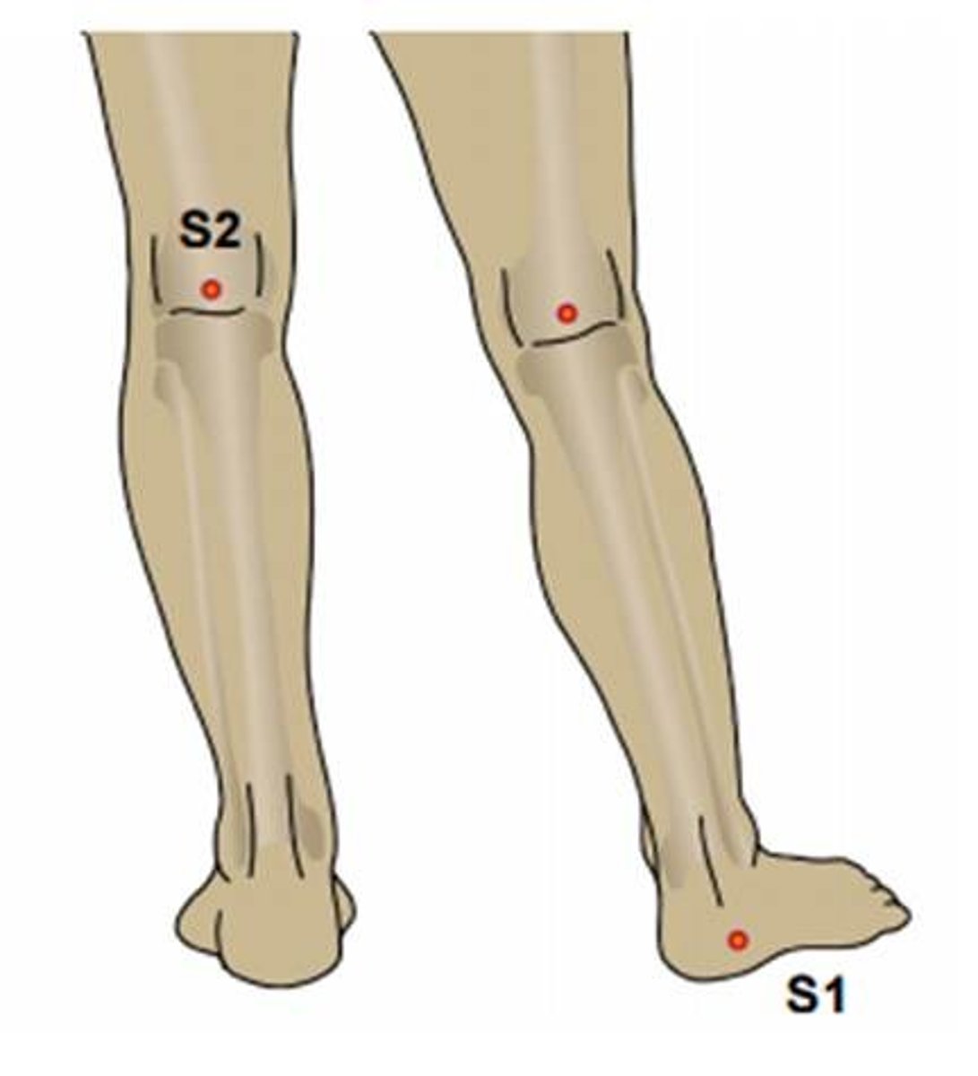 <p>lateral side of the foot</p>