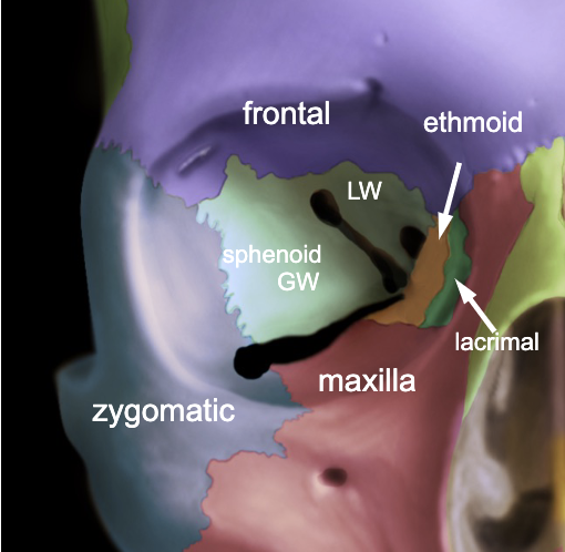 <p>frontal<br>maxilla<br>zygomatic<br>lacrimal<br>ethmoid<br>sphenoid</p>