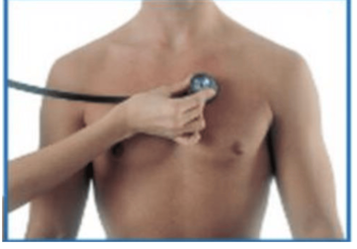 <p>B. Pulmonary valve</p>