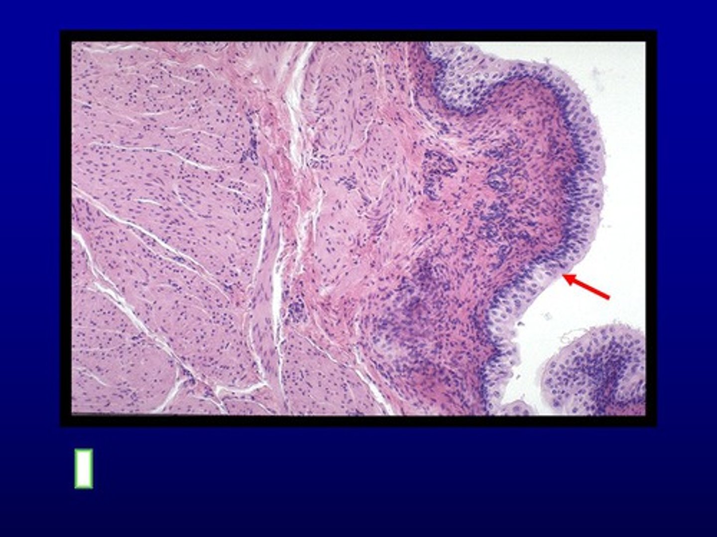 <p>Identify this urinary system structure.</p>