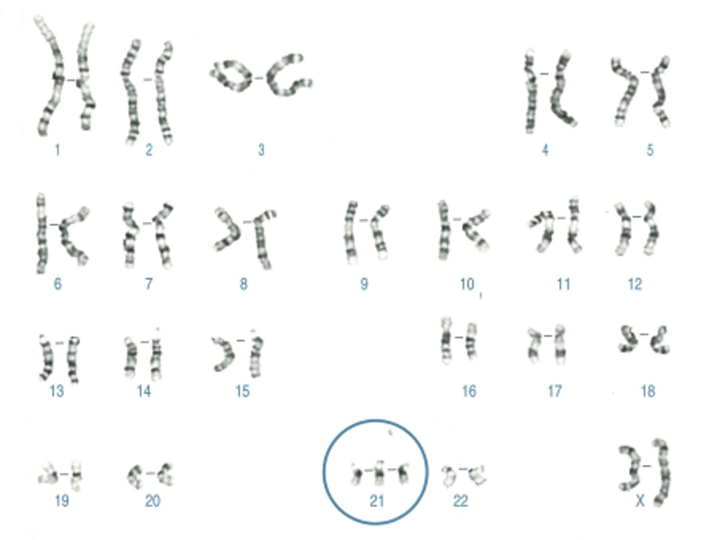 <p>Name:</p><p>- Correctly written karyotype</p><p>- Common name</p><p>- Scientific name</p><p>- One distinguishing clinical feature</p><p>- Definition of this feature if not obvious</p>