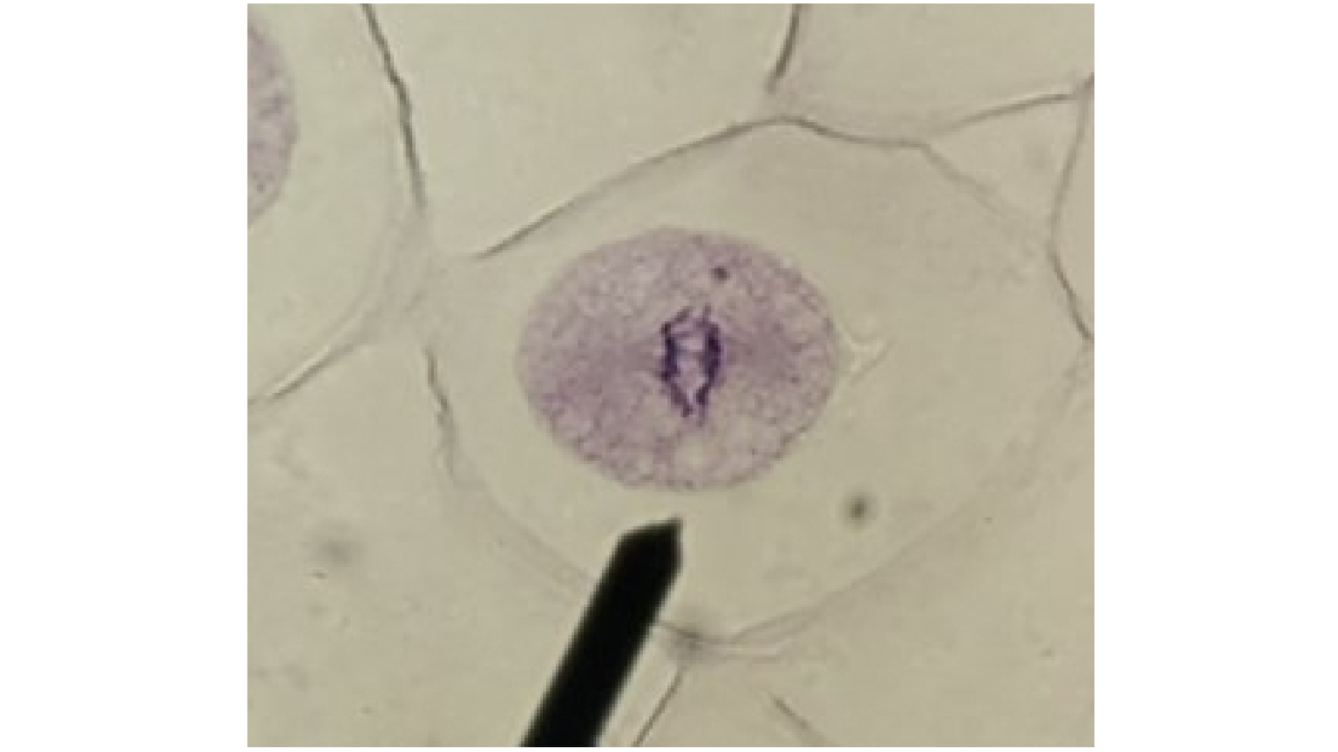 <p>What stage is the cell in?</p>