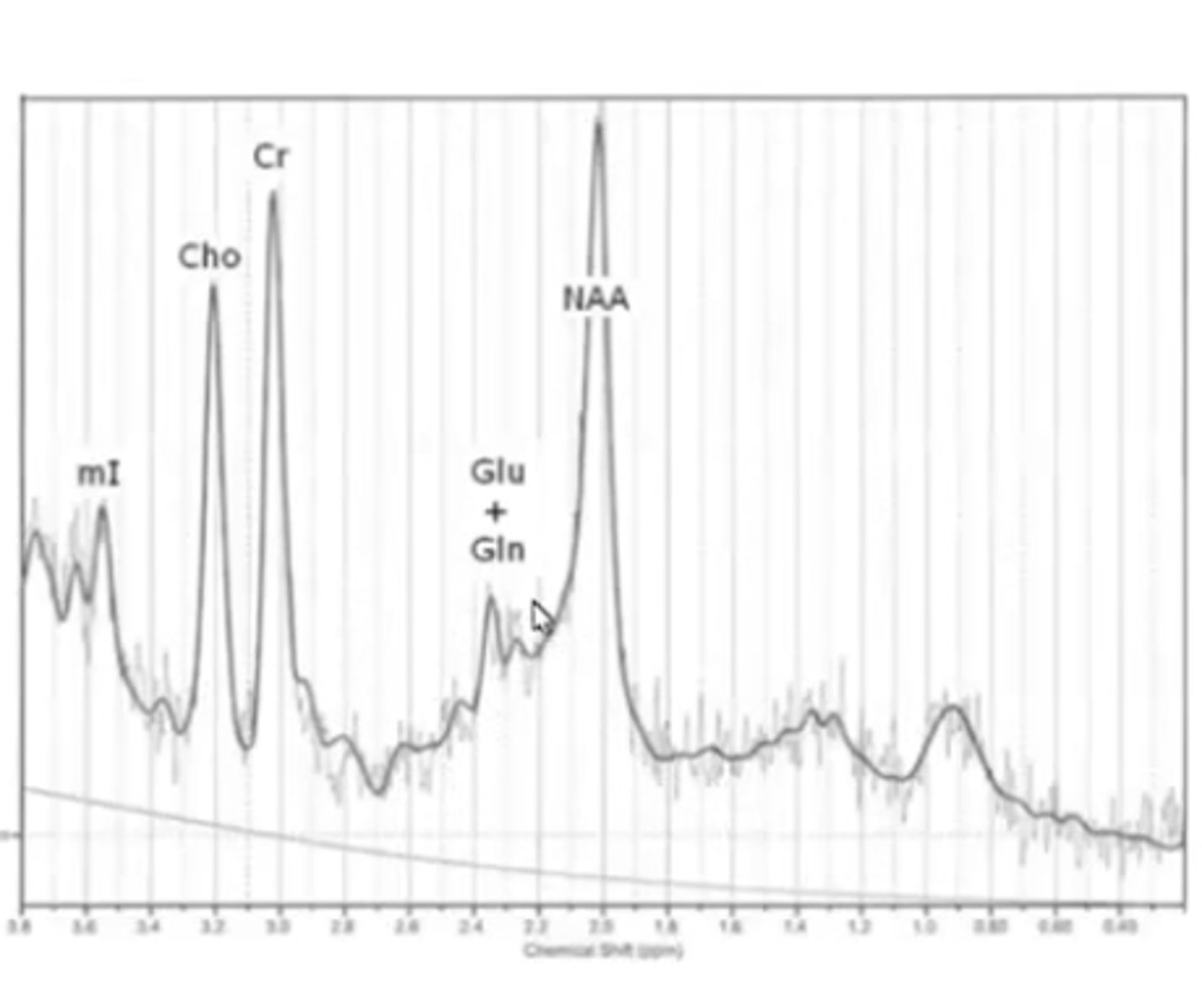 <p>A neuroimaging technique to identify neuro-metabolites changes in the brain </p><p>- magnetic resonance spectroscopy.</p><p>- represents the levels of diferent nts. </p>