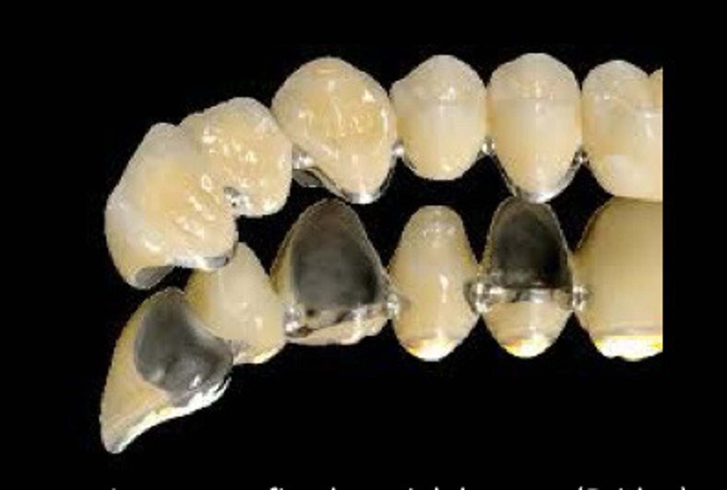 <p>__ indications are used (due to strength at the connectors)</p>