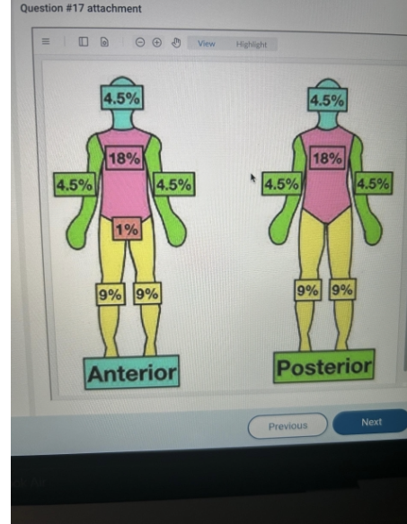 <p><span style="background-color: transparent; font-family: "Times New Roman", serif;"><span>A nurse uses the rule of nines to assess a patient with full thickness burn injuries to the</span></span></p><p><span style="background-color: transparent; font-family: "Times New Roman", serif;"><span>entire right arm, front of the head, and entire right leg. How should the nurse document the percentage of the patient's body that sustained burns?</span></span></p>