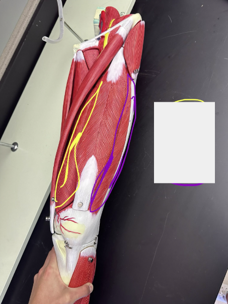 <p>What muscle is the yellow line indicating? </p>
