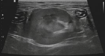 <p>what view is this ultrasound of the kidneys?</p>