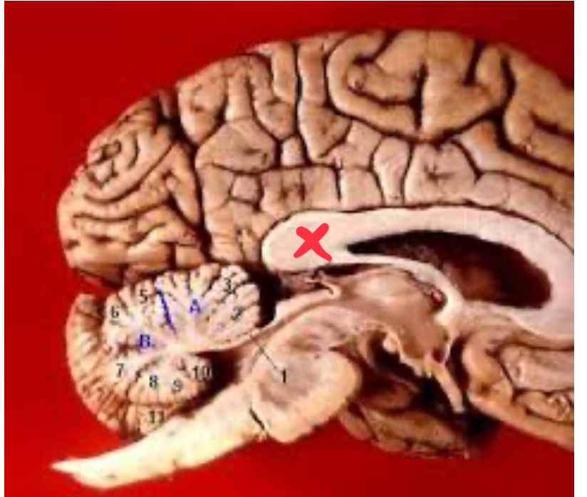 <p>What part is this?</p>