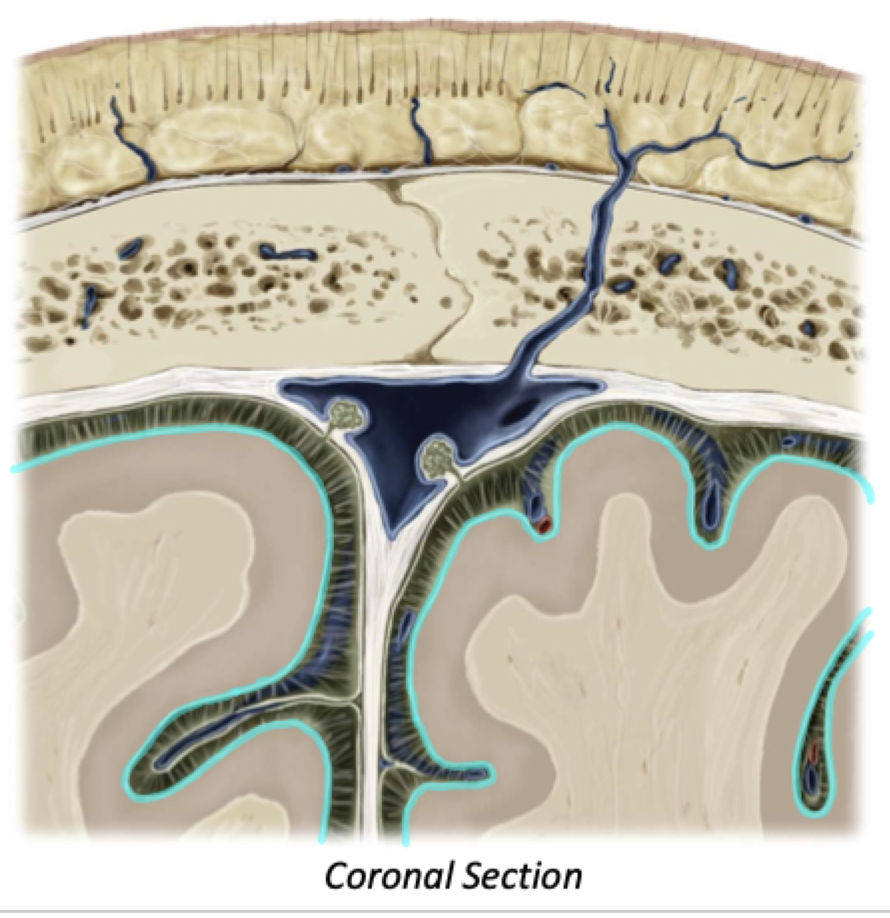 <ul><li><p>Closely covers cortical sulci and gyri</p></li><li><p>Subpial Space exists between Pia and Cortex</p><ul><li><p>This is another potential space not normally present</p></li></ul></li></ul>