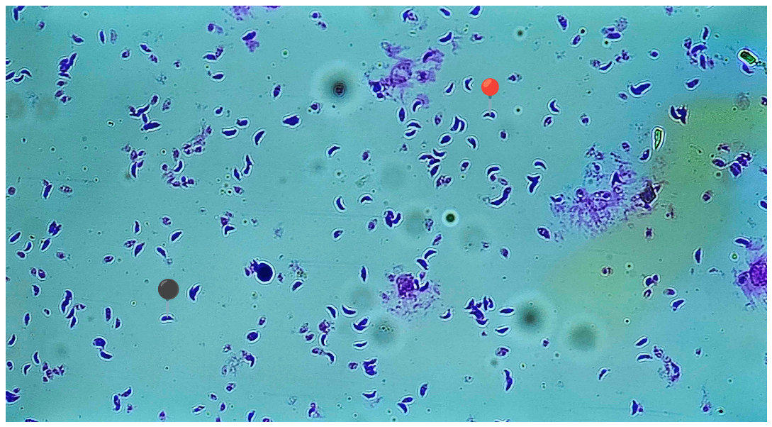 <p><strong><em>Toxoplasma gondii</em></strong></p><p>(Trofozoit)</p><p></p><p></p><p><strong>Parazytoza:</strong><em> Toksoplazmoza</em></p>