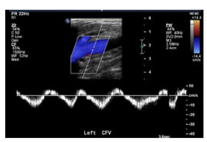 <p>is this waveform abnormal or normal?</p>