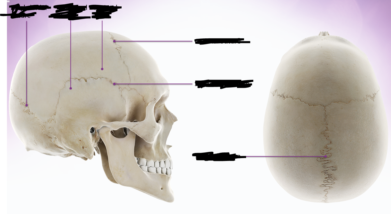 <p>sutures and bone</p>