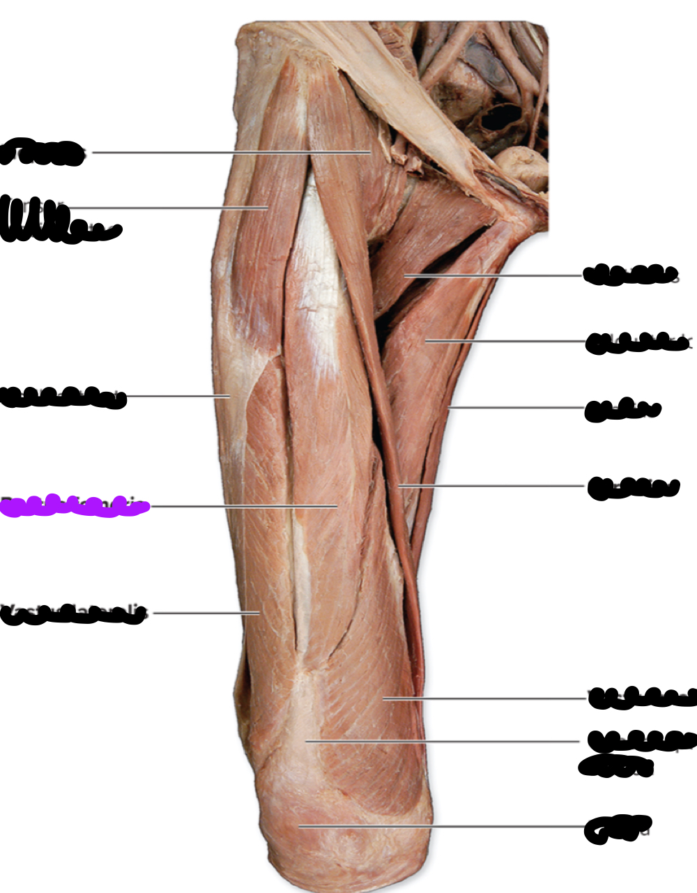 <p>Innervation?</p>