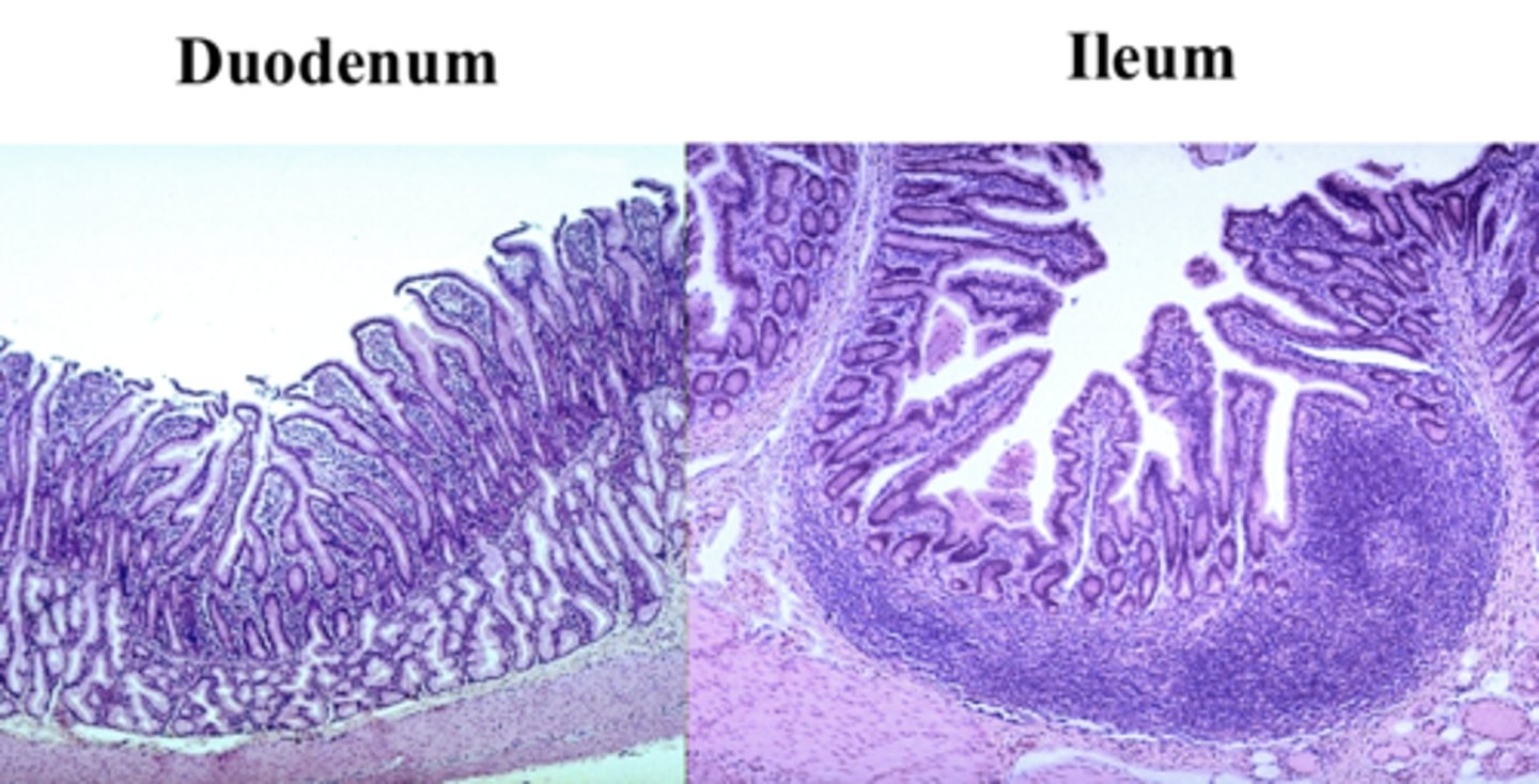 <p>duodenum and ileum vs jejunum</p>