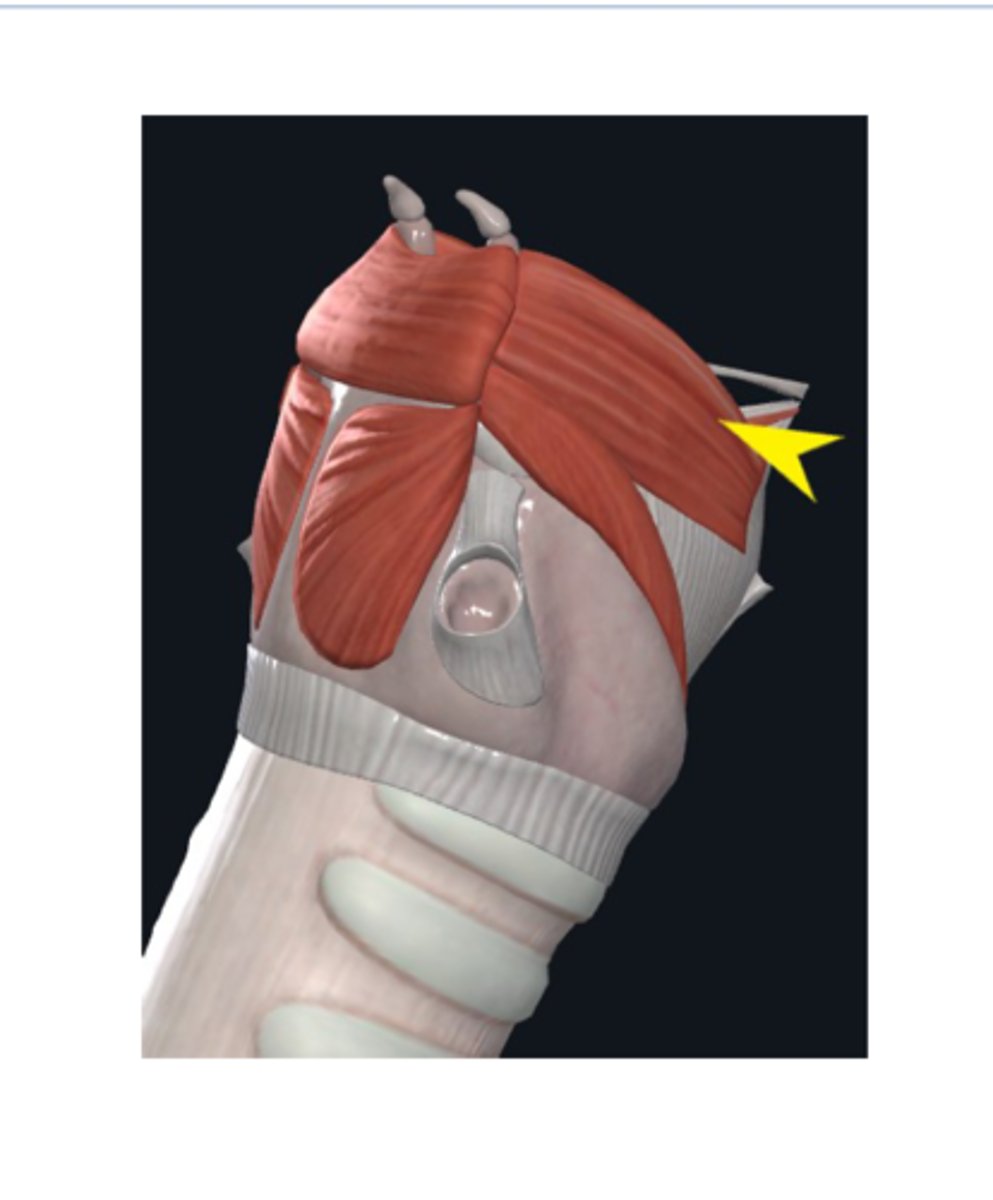 <p>What muscle is this?</p>