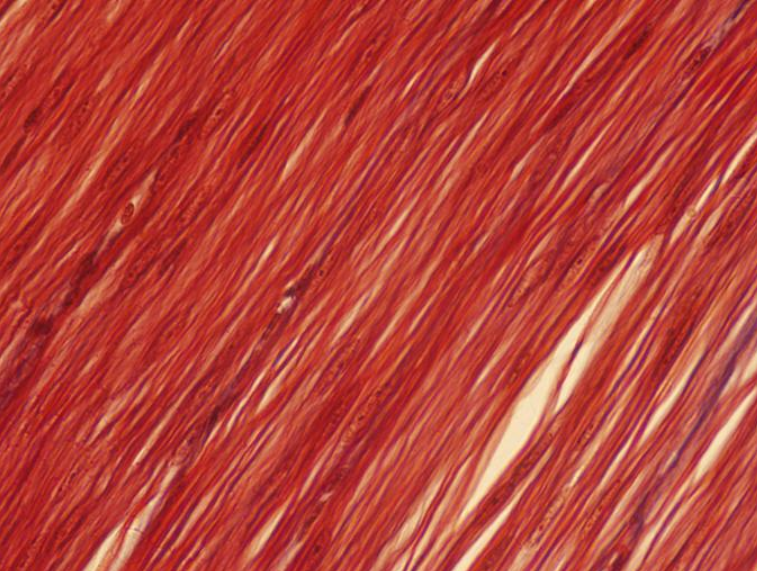 <p>Identify the type of muscle tissue shown ho</p>