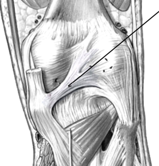 <p>Which ligament of the knee:</p><ul><li><p>Located on posterior side of knee</p></li><li><p>Connects the tibial medial condyle to the femur lateral condyle</p></li><li><p>Diagonal</p></li></ul><p></p>