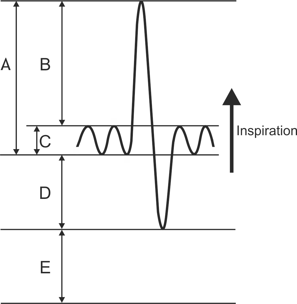 <p>23. The diagram below schematically shows normal breathing as well as maximal inspiration and expiration, with lung volumes/capacities labeled A to E.</p><p>You have a pneumotachograph and want to perform follow-up pulmonary function testing on a patient.</p><p>Which of the parameters A to E cannot be measured using the pneumotachograph?</p><p>A. (A)</p><p>B. (B)</p><p>C. (C)</p><p>D. (D)</p><p>E. (E)</p>