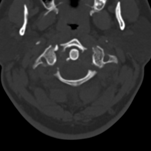 <p>what kind of fracture</p>