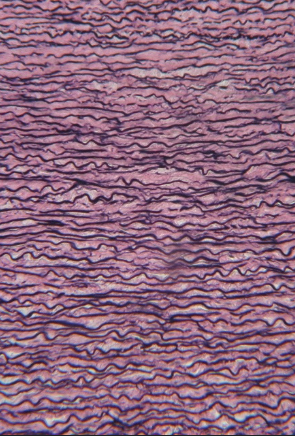 <p>Which connective tissue is this?</p>