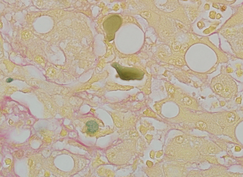 <p>H&E- appears brown</p><p>Fouchet Hall Bile- olive green </p>