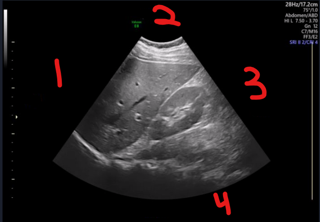 <p>label each number and determine the imaging plane</p>