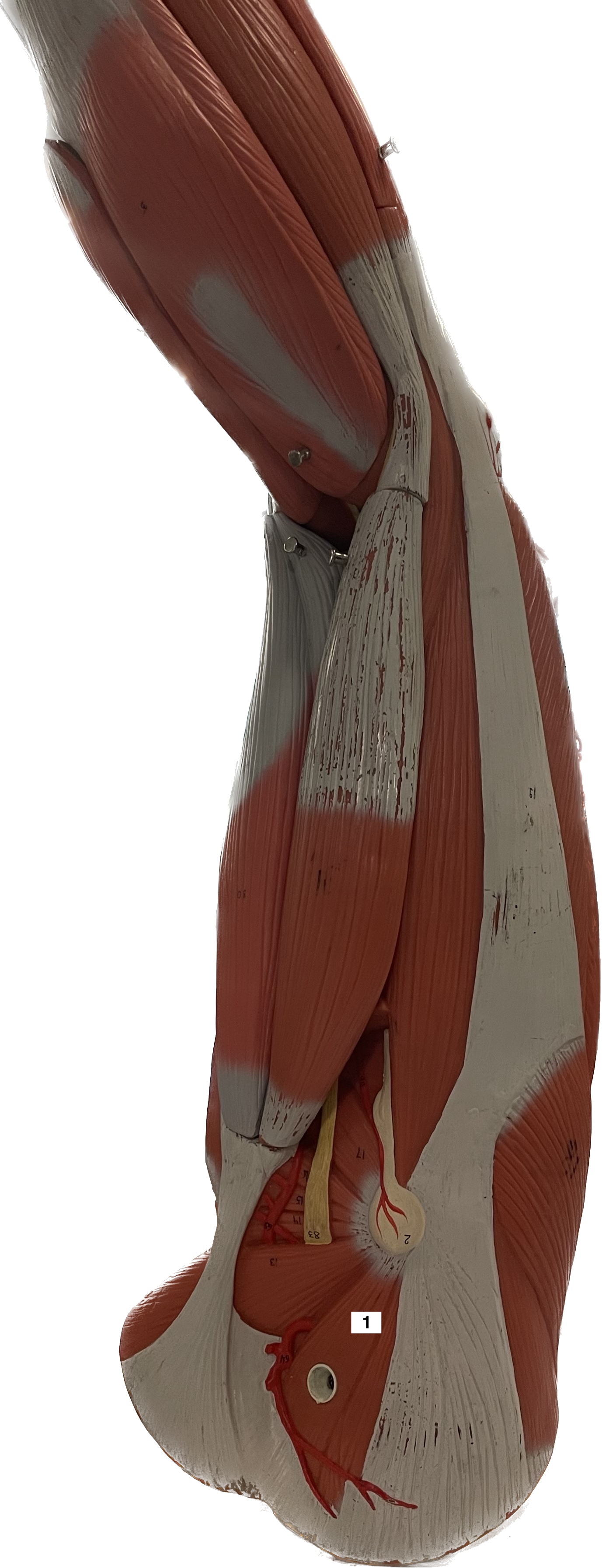 gluteus medius - abducts thigh