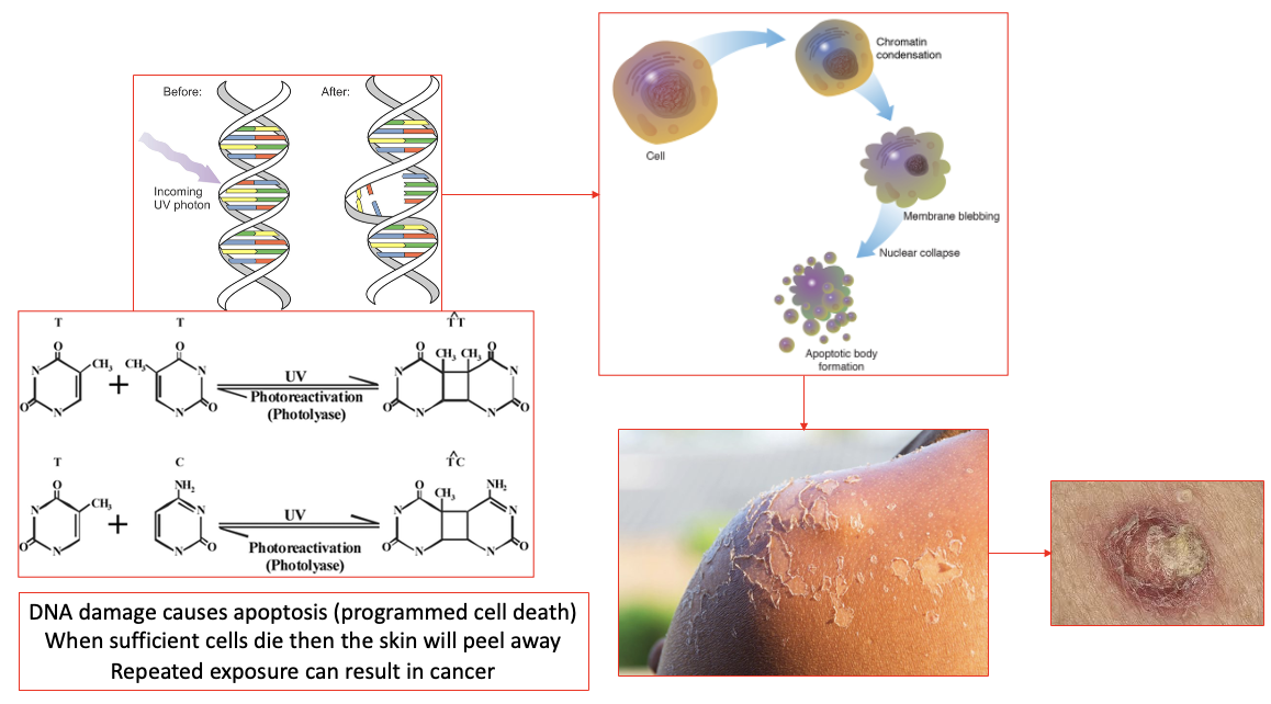 <ul><li><p>UV light breaks the bonds between DNA bases (left side)→ bases reform in different ways → rings form a tricyclic structure (right side)</p></li><li><p>when we’re young, we are good at repairing this DNA damage</p></li><li><p>body responds to this DNA damage by apoptosis (programmed cell death)</p></li><li><p>when sufficient cells die, the skin will peel away</p></li><li><p>repeated exposure makes it harder to repair → cancer </p></li></ul><p></p>