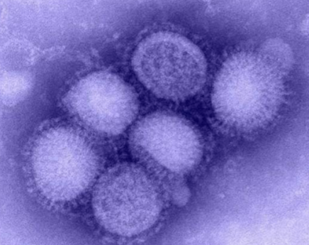 <p>What virus is this?</p>