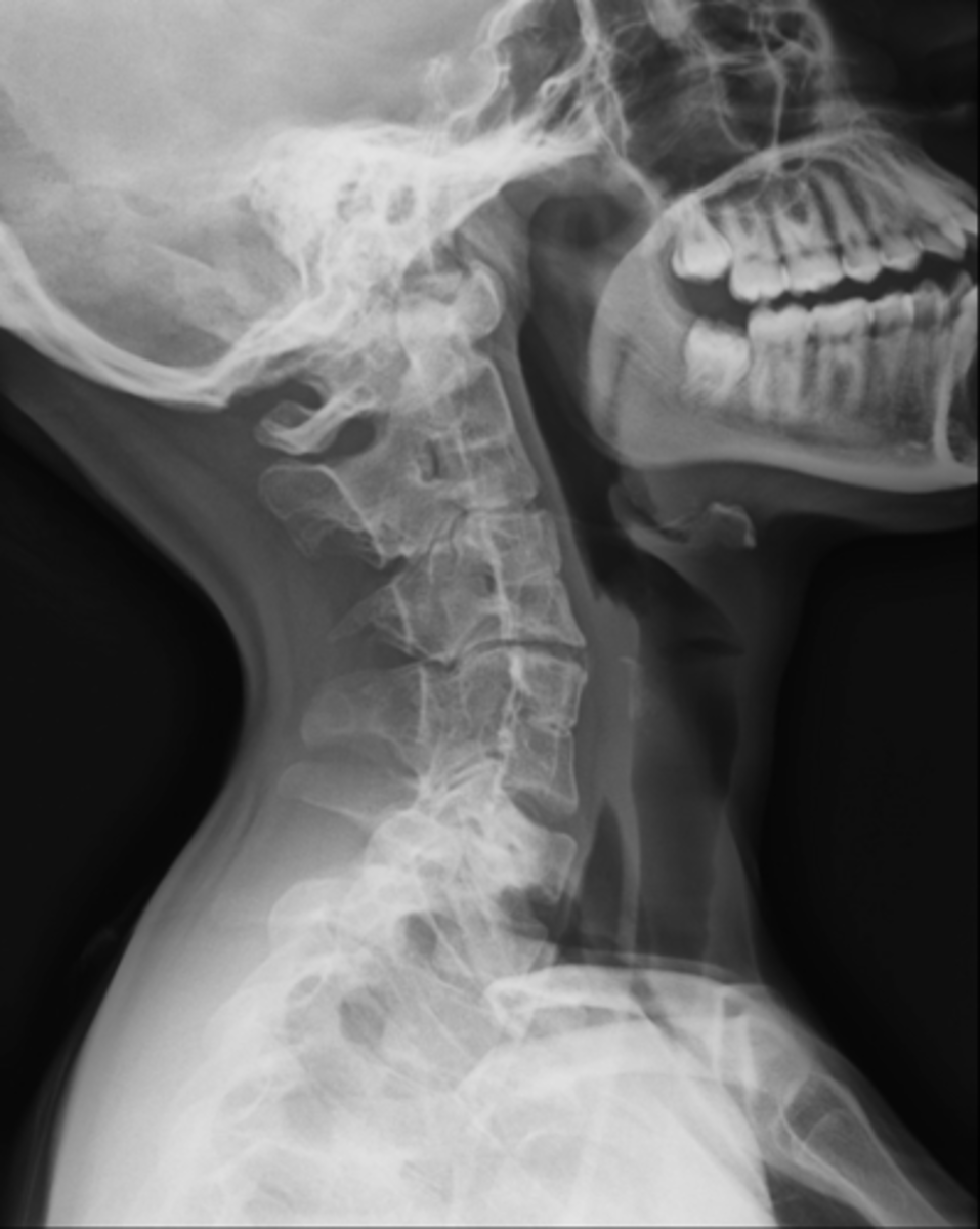 <p>State diagnosis</p>