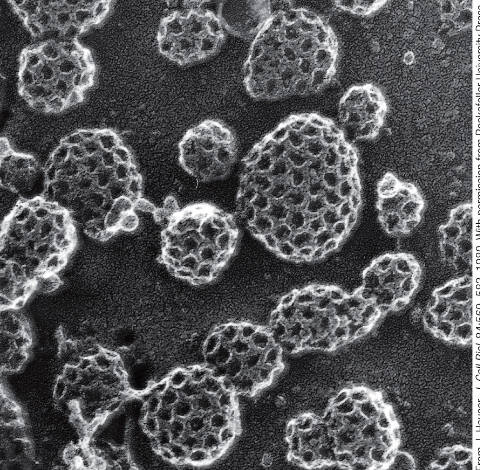 <p>clathrin-coated pit</p>