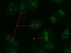 <p>What antinuclear antibody (ANA) staining pattern is demonstrated in this microscopic, fluorescent test image? </p><p>A. Homogeneous </p><p>B. Speckled </p><p>C. Nucleolar </p><p>D. Centromere</p>