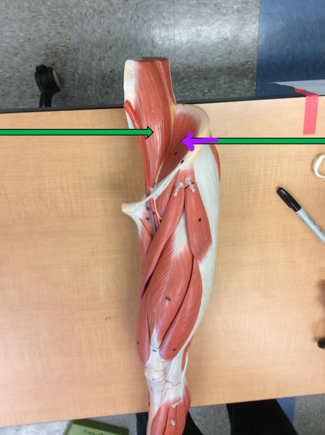 <p>Identify this muscle?</p>