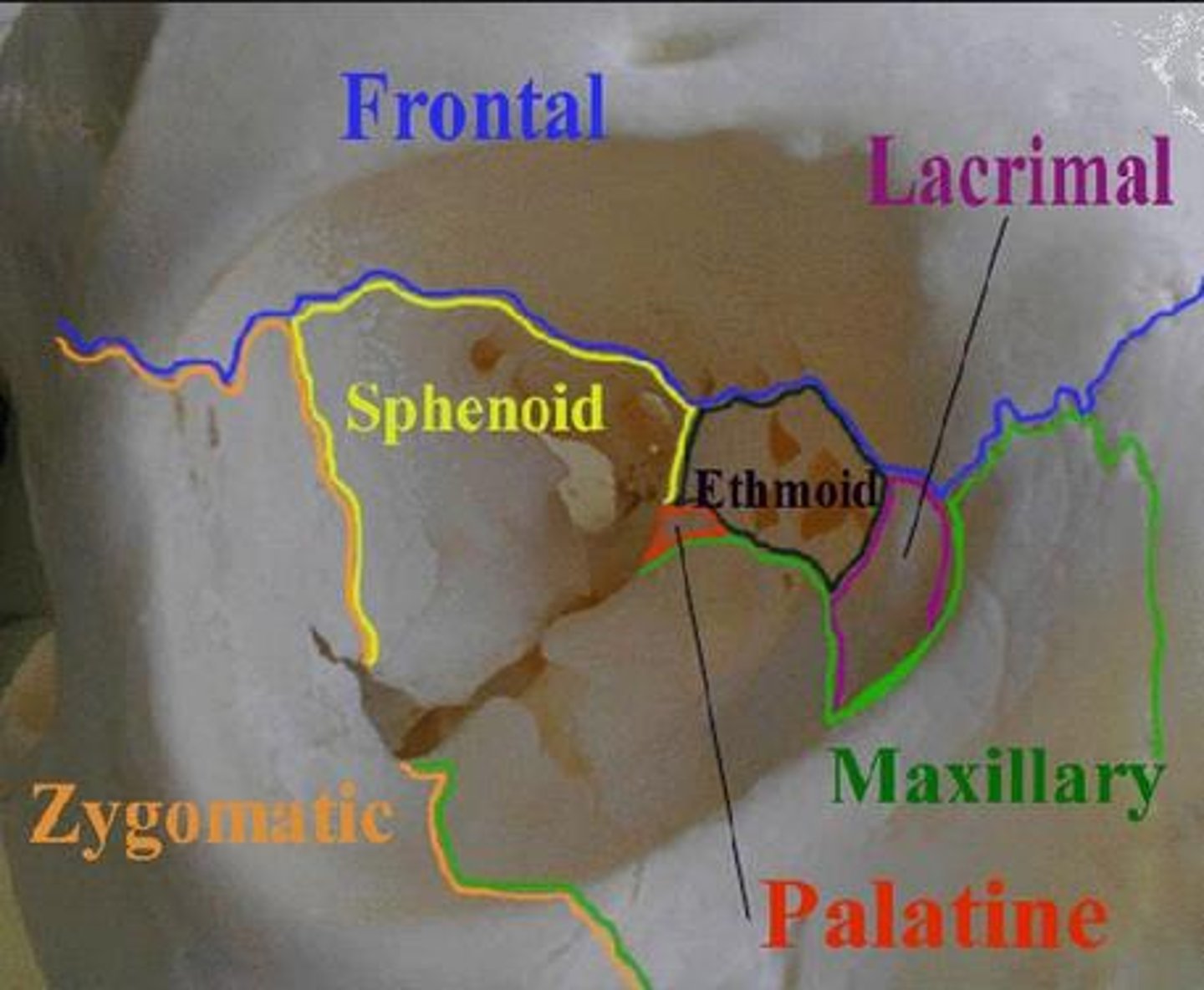 <p>shaped by the frontal, ethmoid, sphenoid bones of the cranium as well as the lacrimal,</p><p>maxilla and zygomatic bones of the facial skeleton</p>