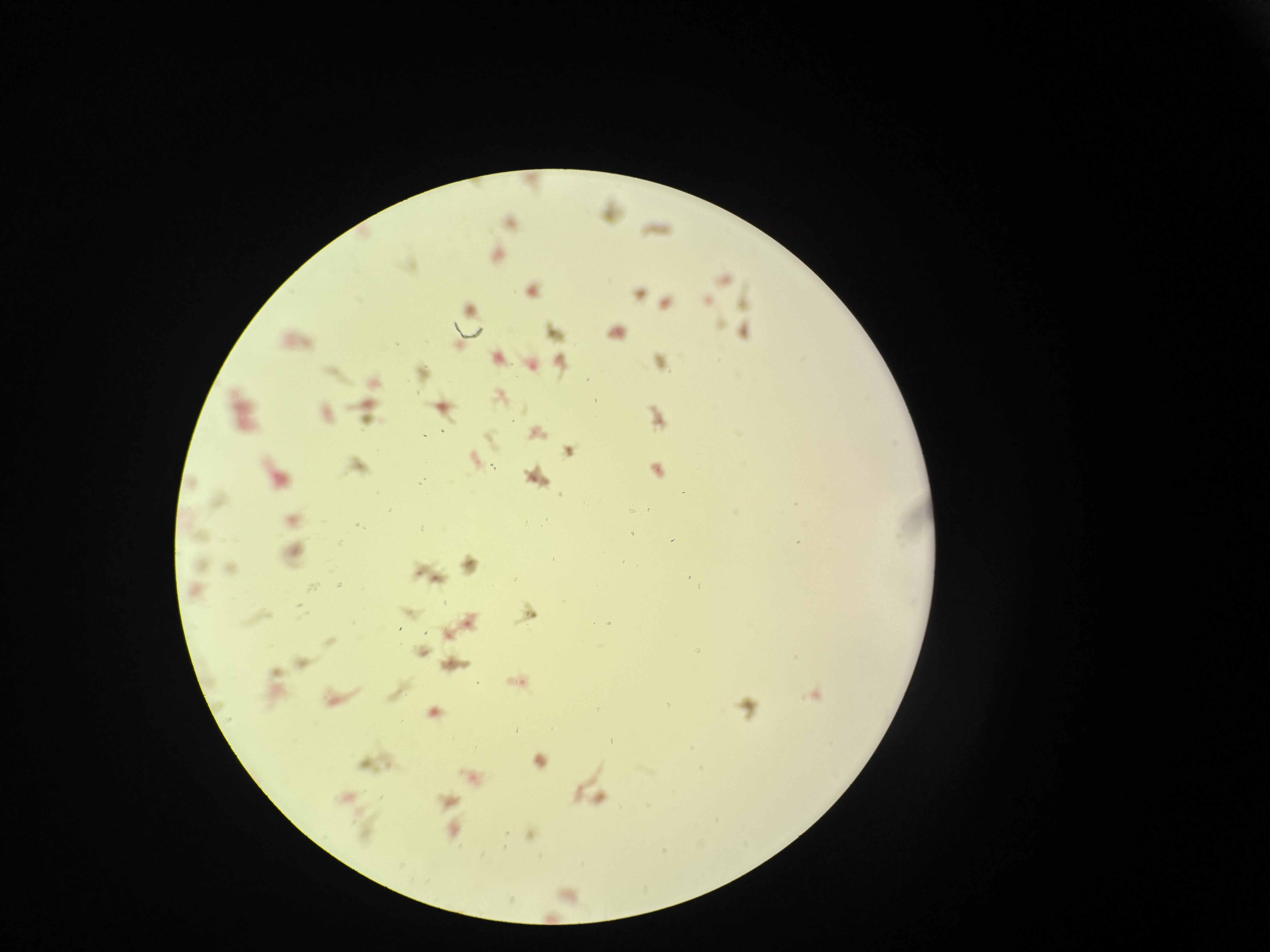 <p>Amoebas</p>