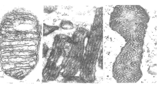 <p>Types of cristae</p>