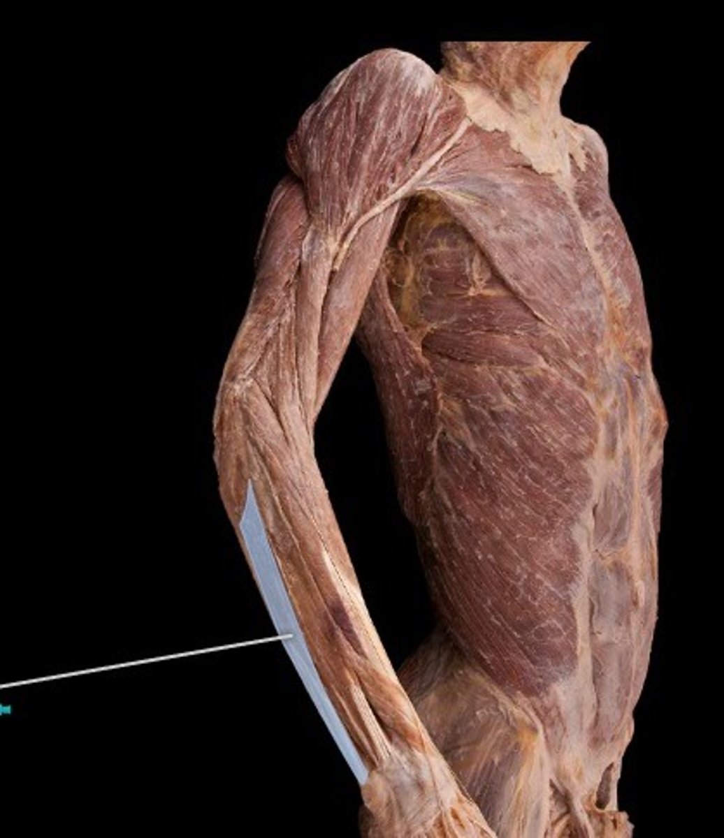 <p>What muscle is this?</p>